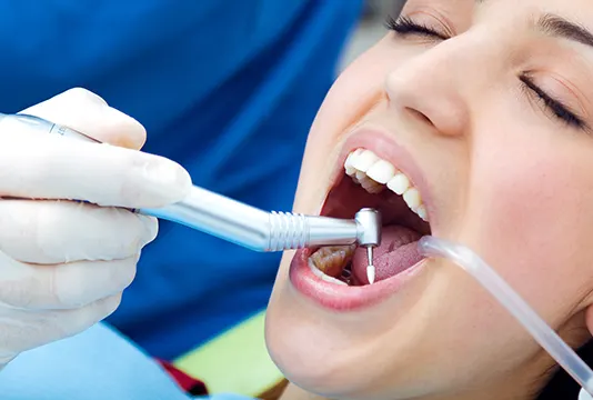 Signs You May Need a Root Canalt