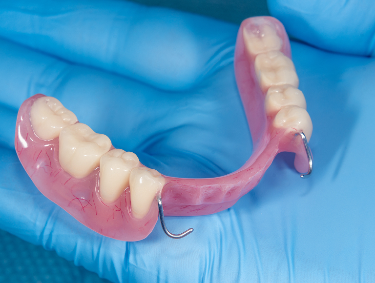 Dentures And Partial Dentures